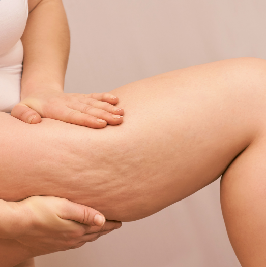 Specialist liposuction in London — patient consultation
